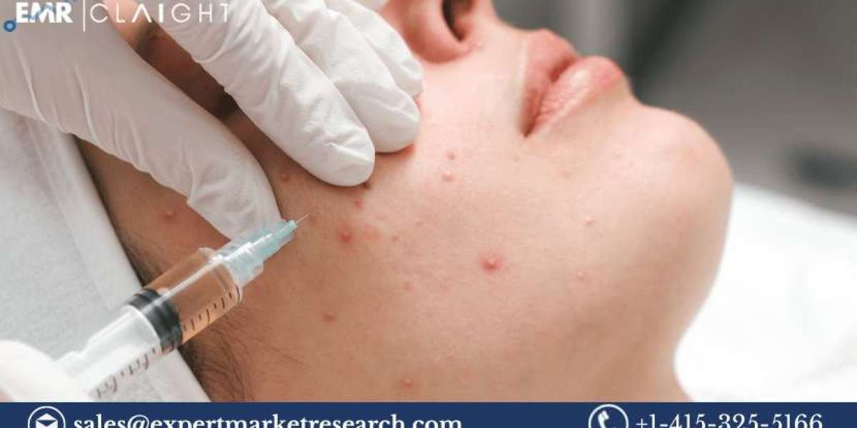 Global Severe Acne Vulgaris Treatment Market Size, Share, Trends, Growth, Analysis, Report and Forecast 2024-2032