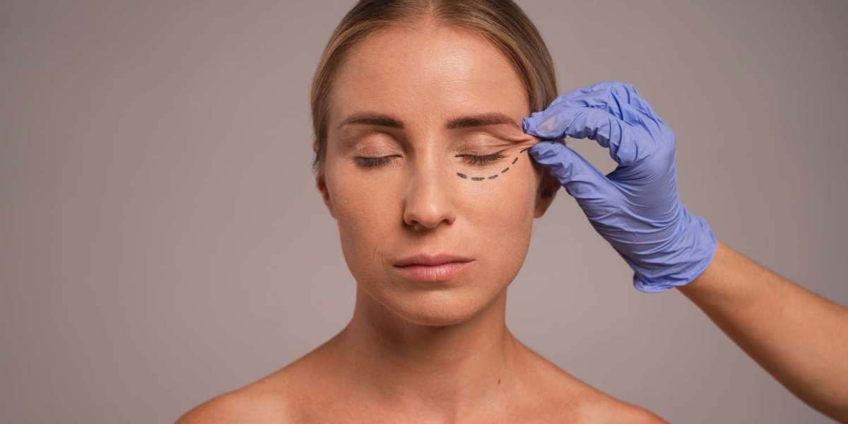 Get a Fresh, Refreshed Look with Blepharoplasty in Raleigh, NC