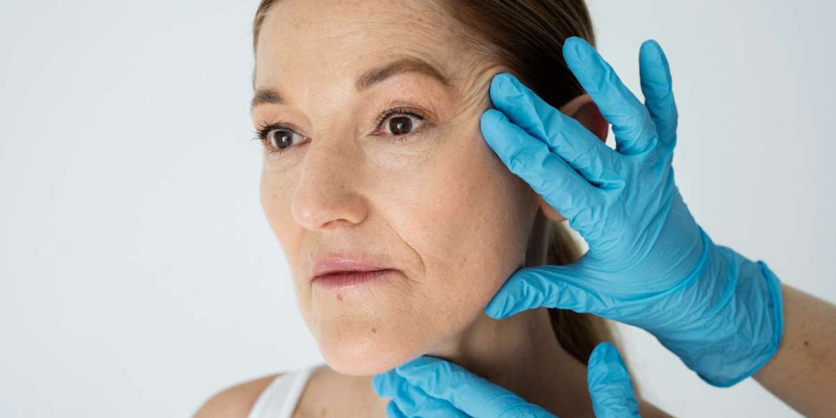 Fillers for Jowls: Guide to Smoother Skin