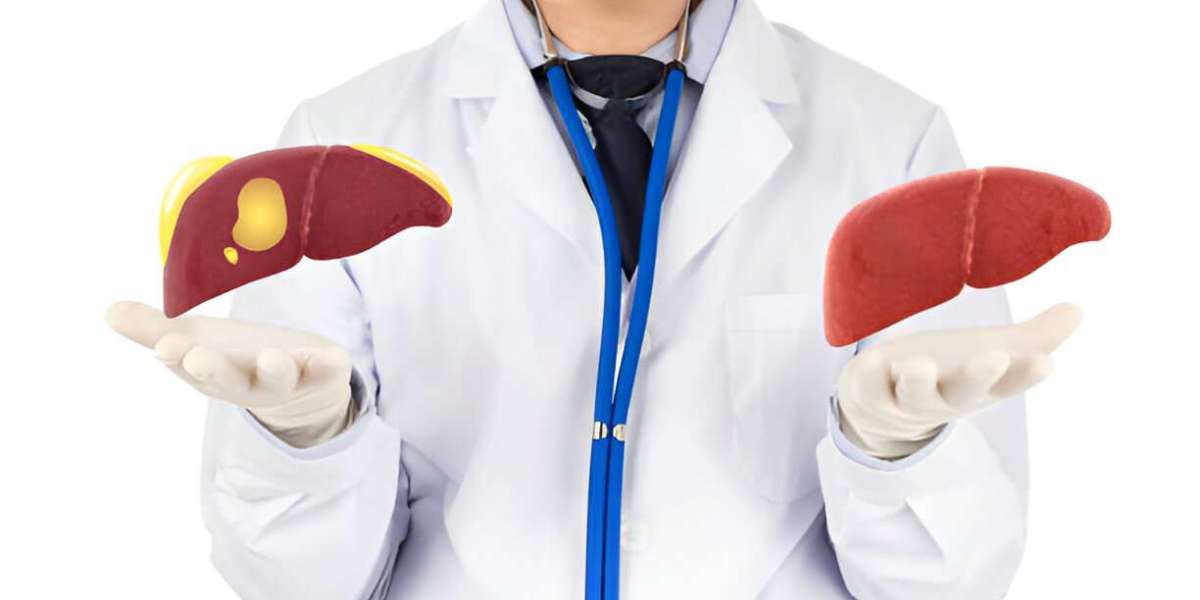 Best Hospitals for Liver Surgery in India: A Comprehensive Guide