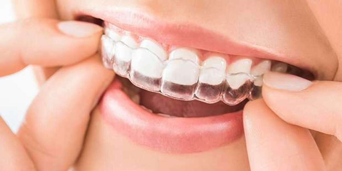 Arch Dental Woodbury provides Invisalign treatment in Suffolk County New York.