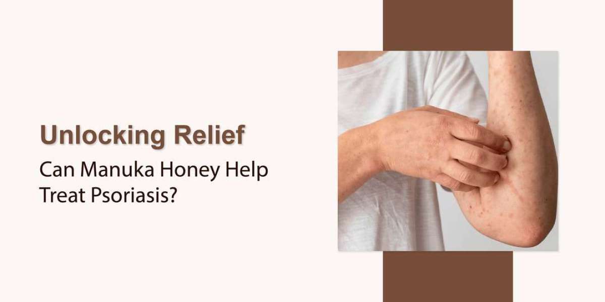 How Honey Helps Relieve Psoriasis Symptoms