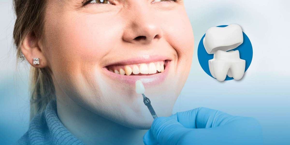 Best Teeth extraction specialist in Coquitlam & Affordable Implants