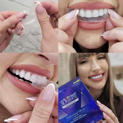 Crest 3d Whitening Strips UK – Achieve a Brighter Smile with The White Smiles Profile Picture