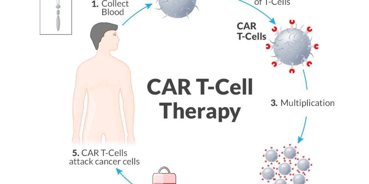 CAR-T የሕዋስ ሕክምና ምንድን ነው እና የካንሰር እንክብካቤን እንዴት ይለውጣል?